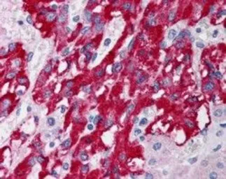 Anti-DLC1 (Isoforms 1 and 3) antibody, N-term used in IHC (Paraffin sections) (IHC-P). GTX89689