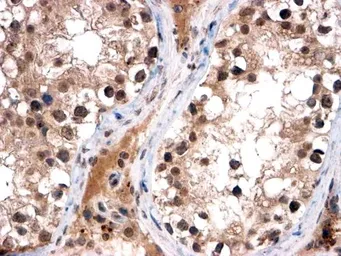 Anti-FOXI1 antibody, C-term used in IHC (Paraffin sections) (IHC-P). GTX89700