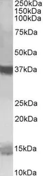 Anti-Prefoldin 1 antibody, C-term used in Western Blot (WB). GTX89717