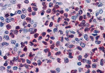 Anti-FLAP antibody, C-term used in IHC (Paraffin sections) (IHC-P). GTX89725
