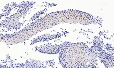 Anti-PAX3 antibody, N-term used in IHC (Paraffin sections) (IHC-P). GTX89743