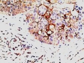 Anti-EPS8 antibody, C-term used in IHC (Paraffin sections) (IHC-P). GTX89748