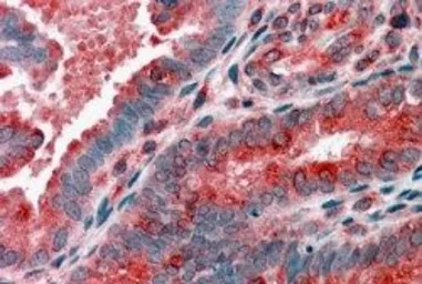 Anti-ACTR1B antibody, C-term used in IHC (Paraffin sections) (IHC-P). GTX89761