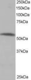 Anti-PPP2R5A antibody, C-term used in Western Blot (WB). GTX89777