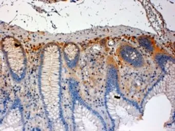 Anti-CSK antibody, C-term used in IHC (Paraffin sections) (IHC-P). GTX89784