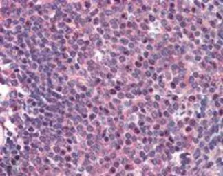 Anti-CARD11 antibody, C-term used in IHC (Paraffin sections) (IHC-P). GTX89813