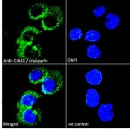 Anti-NLRP3 ( C Terminus) antibody, C-term used in Immunocytochemistry/ Immunofluorescence (ICC/IF). GTX89829