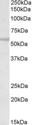Anti-RNF36 antibody, C-term used in Western Blot (WB). GTX89832