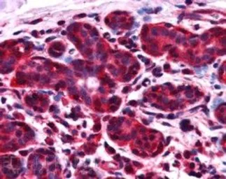 Anti-ALS2CR1 antibody, C-term used in IHC (Paraffin sections) (IHC-P). GTX89849