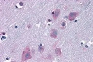 Anti-TRIM2 antibody, C-term used in IHC (Paraffin sections) (IHC-P). GTX89871