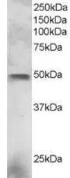Anti-ESE1 antibody, C-term used in Western Blot (WB). GTX89904