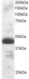 Anti-TFEC antibody, N-term used in Western Blot (WB). GTX89915