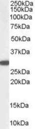 Anti-NQO1 antibody, C-term used in Western Blot (WB). GTX89937