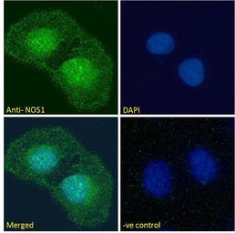 Anti-nNOS antibody, C-term used in Immunocytochemistry/ Immunofluorescence (ICC/IF). GTX89962
