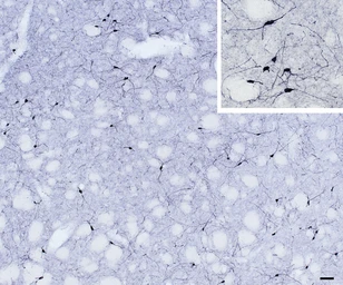 Anti-nNOS antibody, C-term used in IHC (Frozen sections) (IHC-Fr). GTX89962