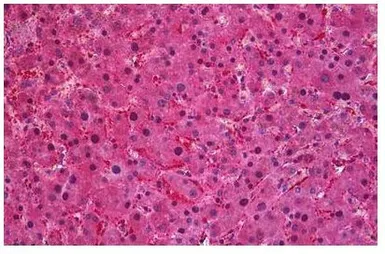 Anti-SEC61A1 antibody, C-term used in IHC (Paraffin sections) (IHC-P). GTX89964