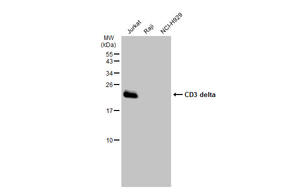 anti-cd3 delta antibody [jj08-97] used in western blot (wb).
