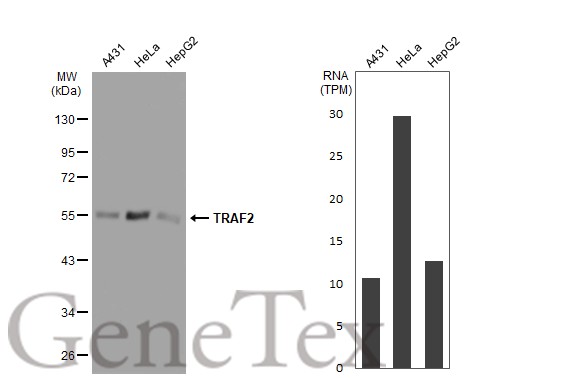 traf2抗体 [sd205-06]