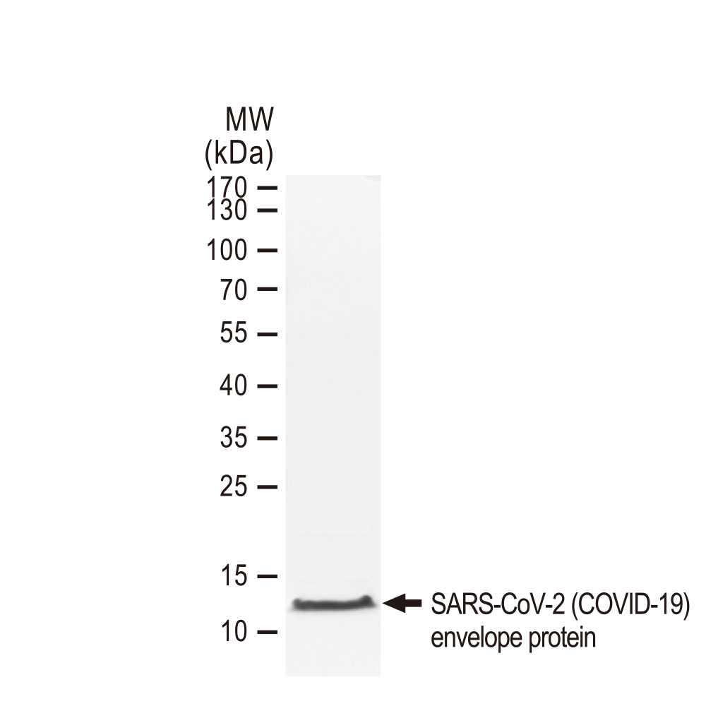 sars-cov-2 (covid-19) envelope protein, his and avi tag.