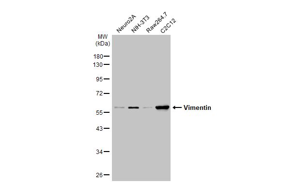 anti-vimentin antibody used in western blot (wb). gtx100619