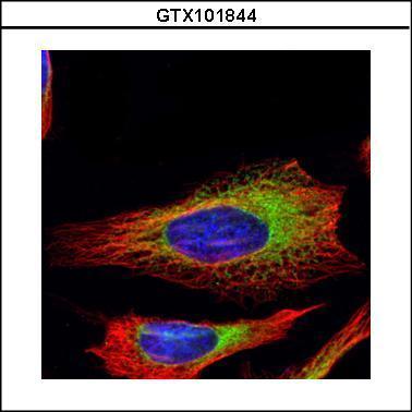 Ribosome binding protein 1抗体 [C3], C-term (GTX101844) | GeneTex中国官方网站