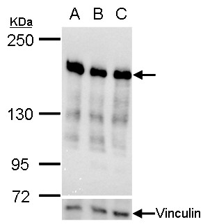 Ribosome binding protein 1抗体 [C3], C-term (GTX101844) | GeneTex中国官方网站