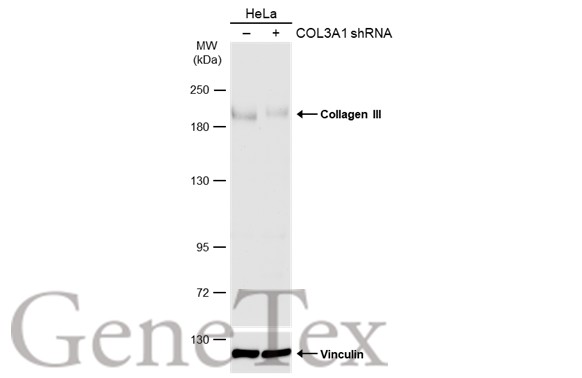 Collagen III抗体 [C2C3], C-term (GTX102997) | GeneTex中国官方网站