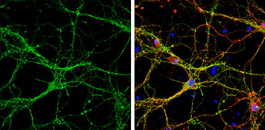 Syntaxin 1a抗体 (GTX113559)