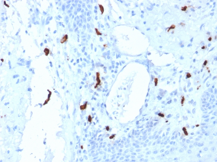 Mast cell tryptase抗体 [TPSAB1/1961] (GTX17823) | GeneTex中国官方网站