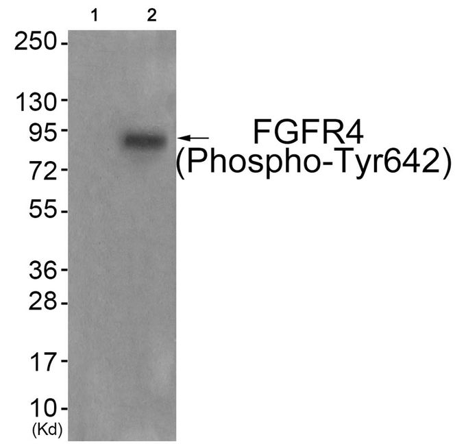 FGFR4 phospho Tyr642 GTX55378 GeneTex fgfr4-phospho-tyr642-gtx55378-genetex