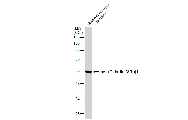 beta Tubulin 3/ Tuj1抗体 [GT11710] (GTX631836) | GeneTex中国官方网站