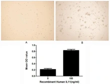 Human IL11 protein, His tag (active). GTX00087-pro