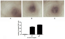 Human MCP4 protein, His tag (active). GTX00107-pro
