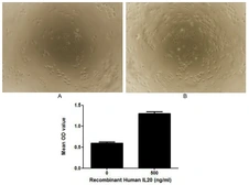 Human IL20 protein, His tag (active). GTX00137-pro