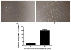 Human CX3CL1 protein, His tag (active). GTX00214-pro