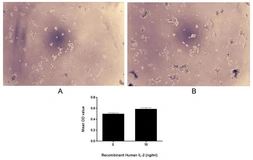 Human IL2 protein, His tag (active). GTX00265-pro