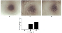 Human C5a protein, His and Fc tag (active). GTX00416-pro