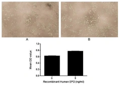 Human EPO protein, His and GST tag (active). GTX00422-pro