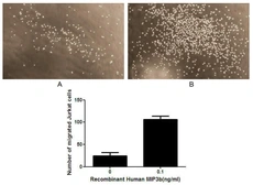 Human MIP3 beta protein, His tag (active). GTX00424-pro