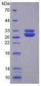 Human SOD3 protein, His tag. GTX00425-pro