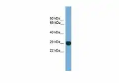 Anti-EIF4E2 antibody used in Western Blot (WB). GTX00636