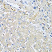 Anti-NAP2 antibody used in IHC (Paraffin sections) (IHC-P). GTX00654