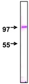 Anti-NUP98 antibody [2H10] used in Western Blot (WB). GTX00697