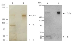 Anti-Clostridium tetani Tetanus toxin antibody [TH-11] used in Western Blot (WB). GTX00715