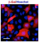 Anti-beta Galactosidase antibody used in Immunocytochemistry/ Immunofluorescence (ICC/IF). GTX00718