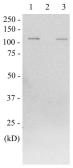 Anti-beta Galactosidase antibody used in Western Blot (WB). GTX00718