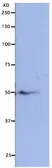 Anti-NUF2 antibody used in Western Blot (WB). GTX00733