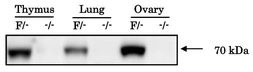 Anti-IGSF8 antibody used in Western Blot (WB). GTX00745