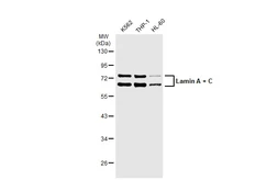 Anti-Lamin A + C antibody [GT1137] used in Western Blot (WB). GTX00774