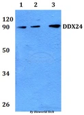 Anti-DDX24 antibody used in Western Blot (WB). GTX00825